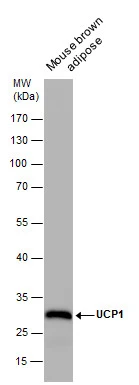 UCP1 antibody [GT3111]